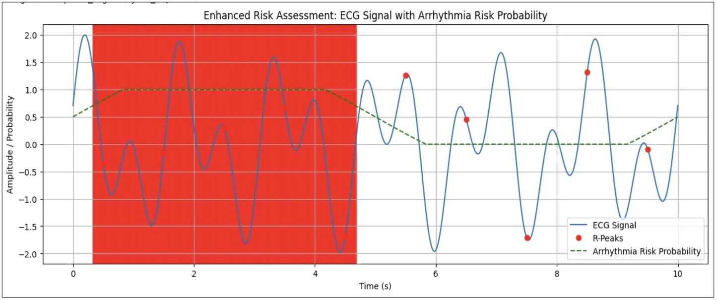 ECG Signal with Arrhythmia Risk Probability