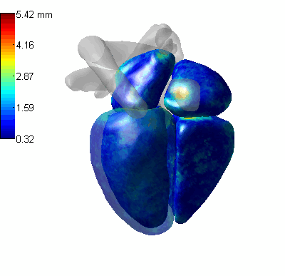 Heart MRI Segmentation GIF